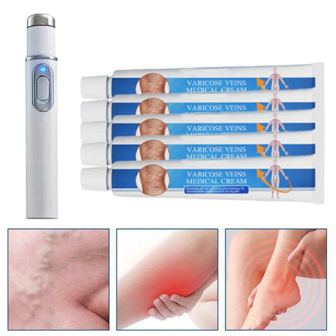 

1 Pc Herbal 5x Varicose Veins Cream for Legs Veins Vasculitis Phlebitis Spider Pain Relief Ointment Foot Care Tool