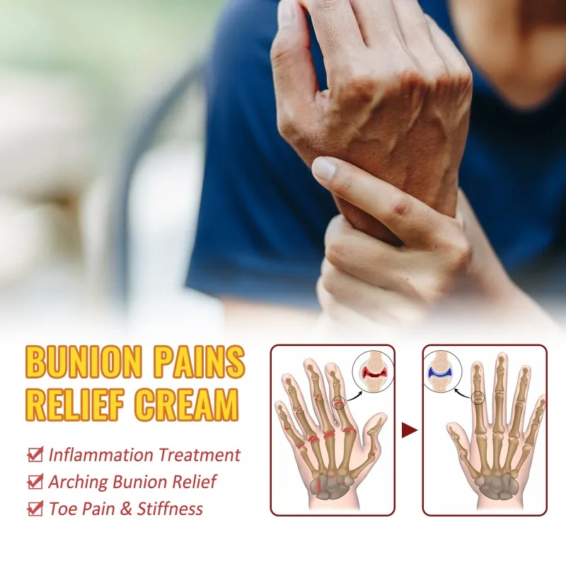 Bunion Pains Cream Joint Care Ointment