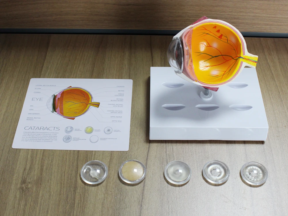 Cornea Eyeball Model Human Eye Demonstration Glaucoma Cataract Anatomy Medical Teaching Tool