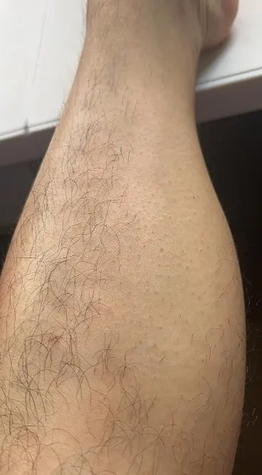 Eelhoe Gentle Mousse Spray Mild Formula for Softer Skin Appearance – Quick, Painless, Safe | 100 ml