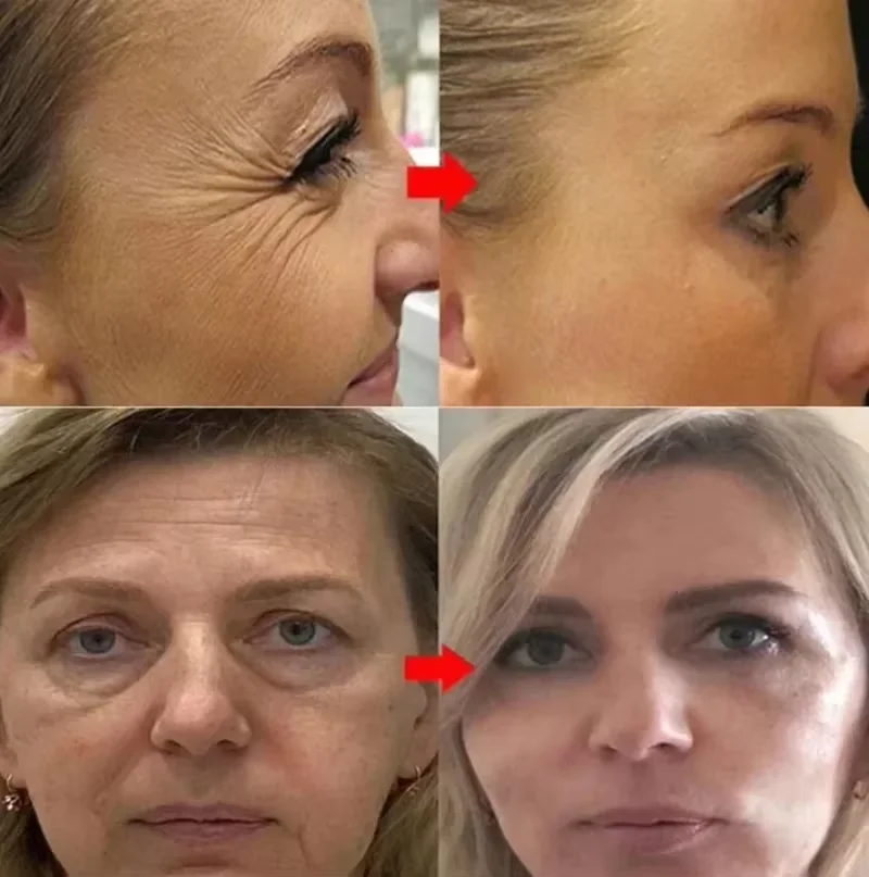 Retinol Remove Wrinkle Face Serum Lift Firming Anti Aging Fade Fine Lines Whitening Brightening Moisturizer Skin Care Cosmetics - Image 3
