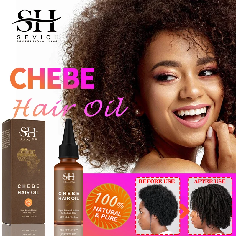 Sevich Fast Hair Growth Products Africa Traction Alopecia Chebe Oil Anti Hair Loss Treatmen Crazy Thicken Hair Serum Hair Care