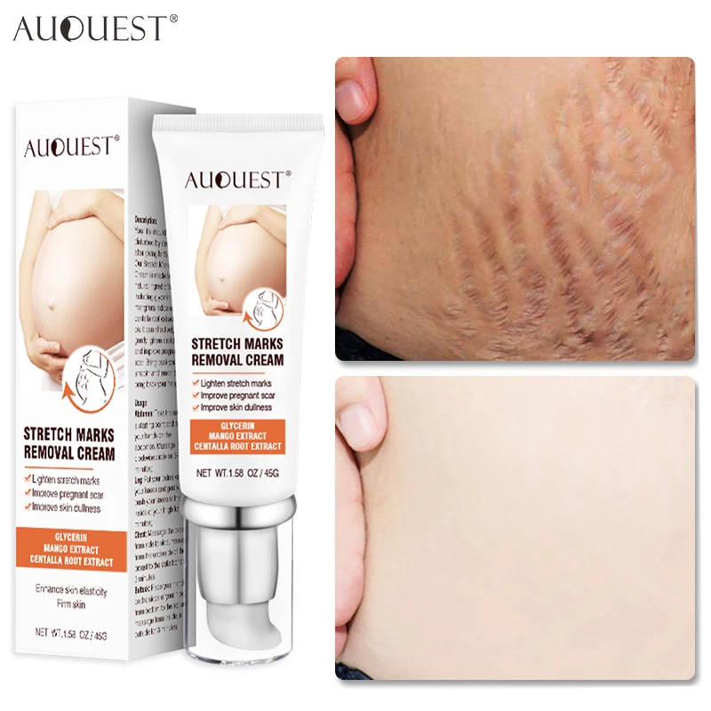 

Stretch Marks Permanent Removal Cream Maternity Pregnant Women Pregnancy Scar Repair Anti-Winkle Firming Skin Body Care