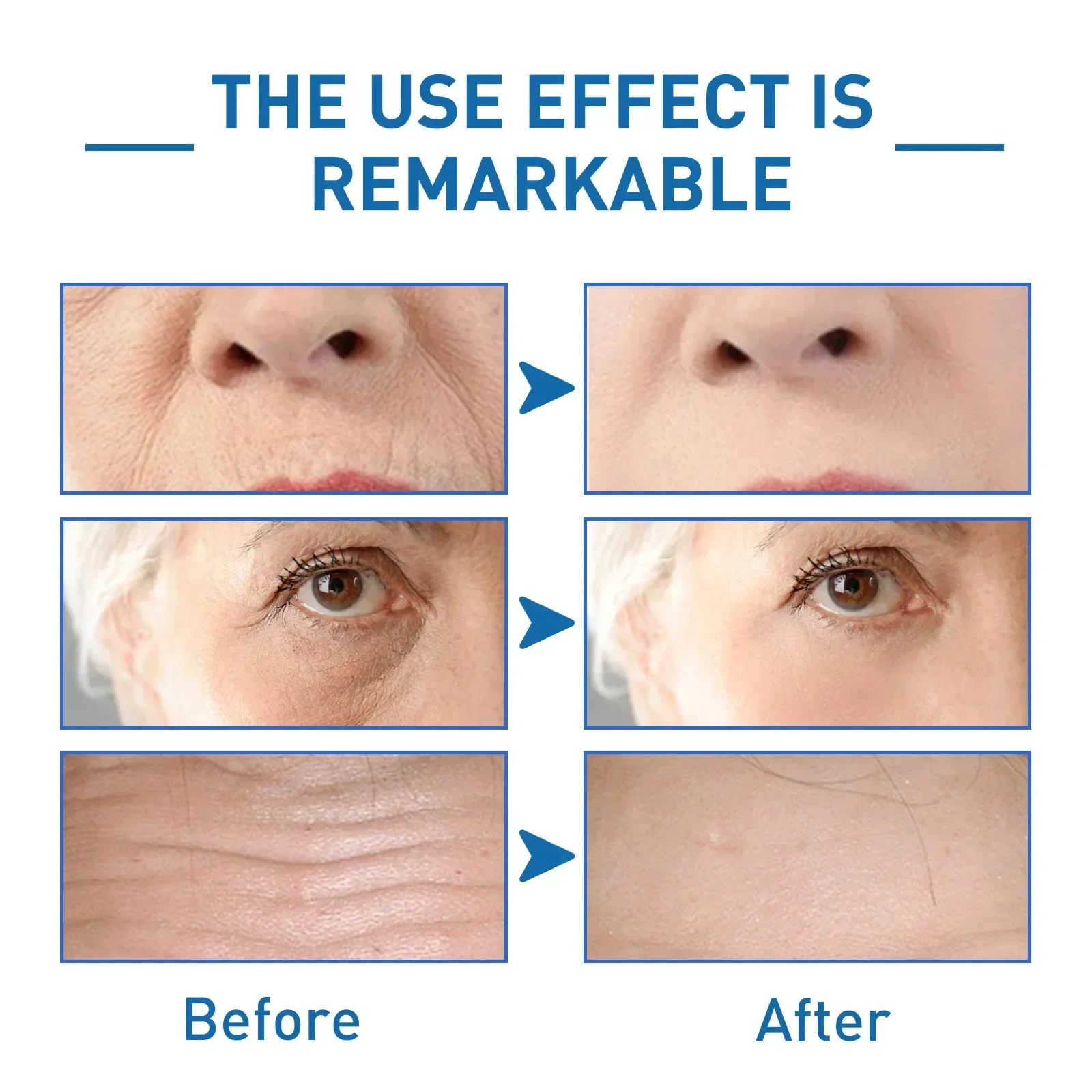 cream, anti-aging Anti-wrinkle essence, facial firming and whitening, dark circle removal, fine lines reductio_voghion.com