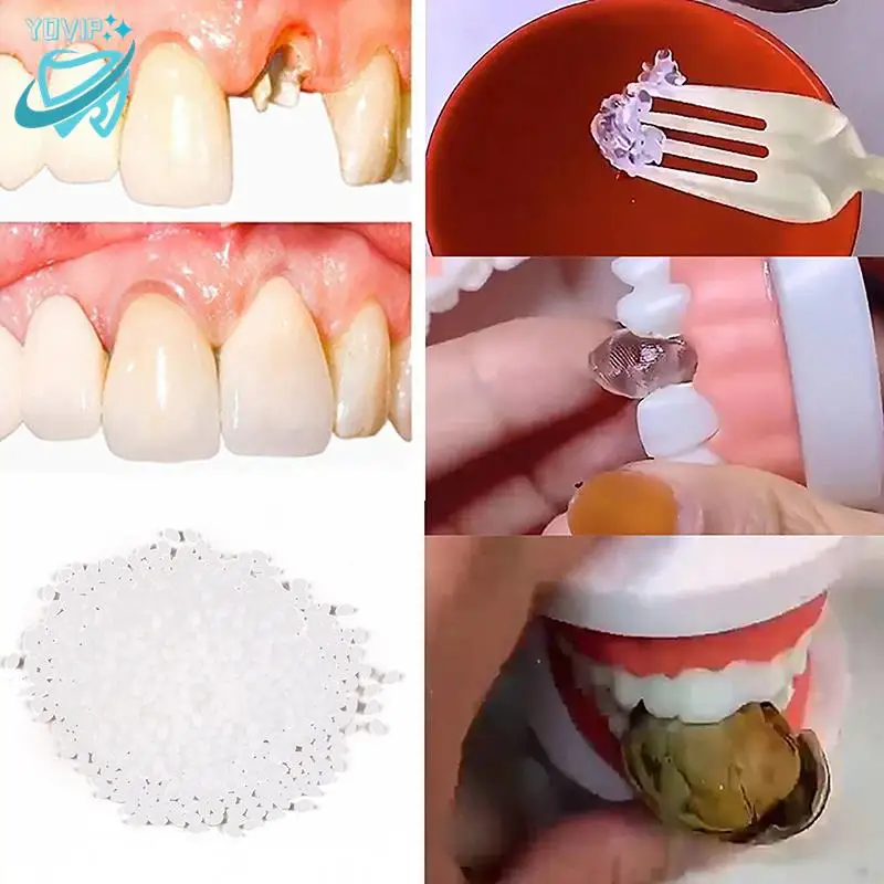 Resin 25g Temporary Tooth Repair Kit Teeth And Gaps False Teeth Solid Glue Denture Adhesive Teeth Whitening Tooth Beauty