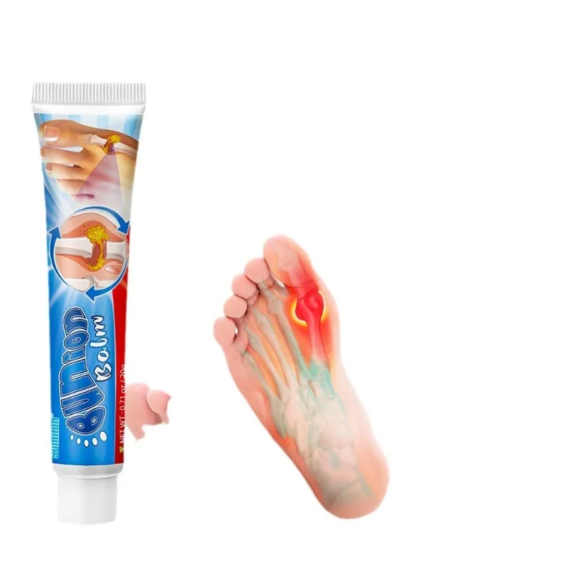 Gout Cream High Uric Bone Damage Relieve Lumbar Spine Stiffness Swelling and Pain Lumbar Disc Herniation Bone Medical Care