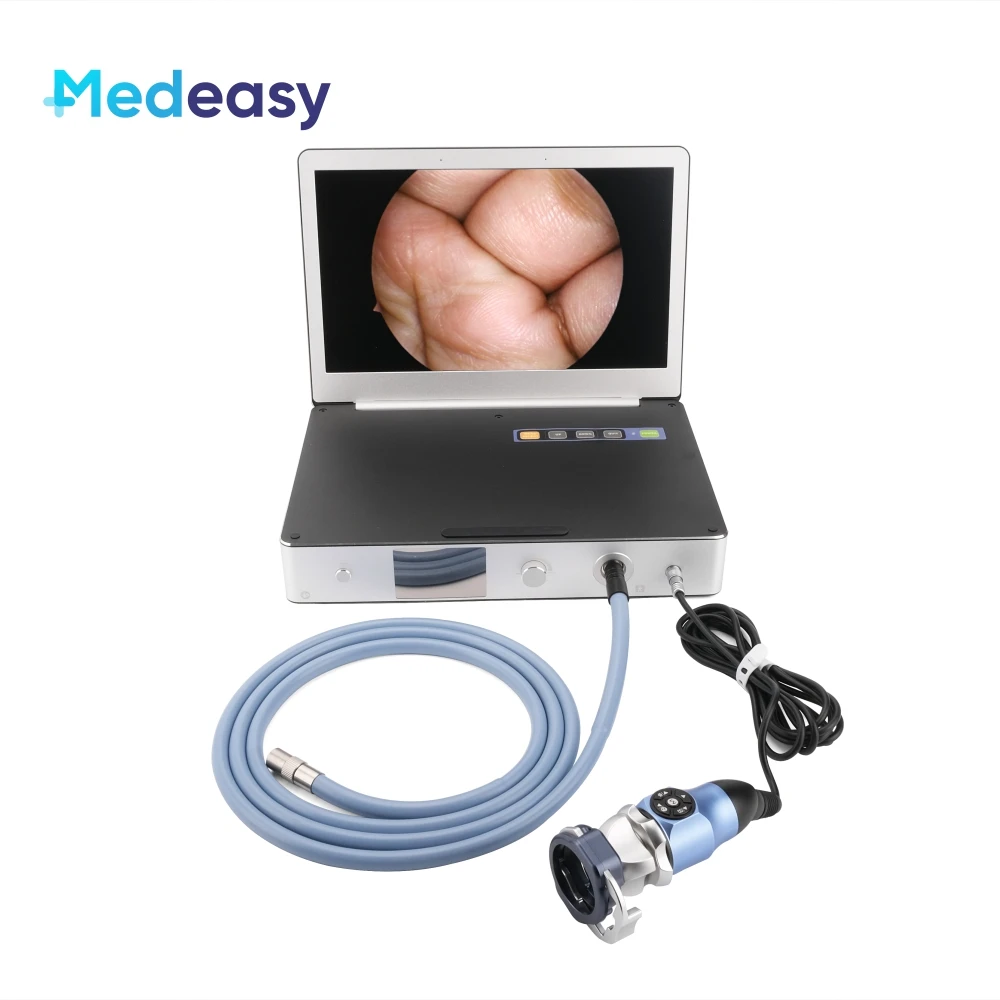 Medical Full HD Endoscope Camera with 30W LED Cold Light Source and 11.6 Inch Monitor