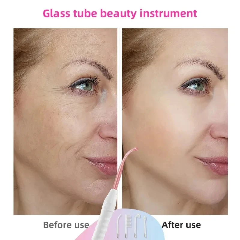 4-in-1 Acne Treatment Facial Device - Glass Electrode Therapy Wand for Spot Reduction & Skin Care, Portable Face Machine 6