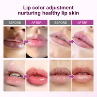 Baume à lèvres rose éclaircissant rapide, exfoliant, estompe la ligne des lèvres, hydratant pour la peau morte, produits de soins coréens, beauté et santé 2