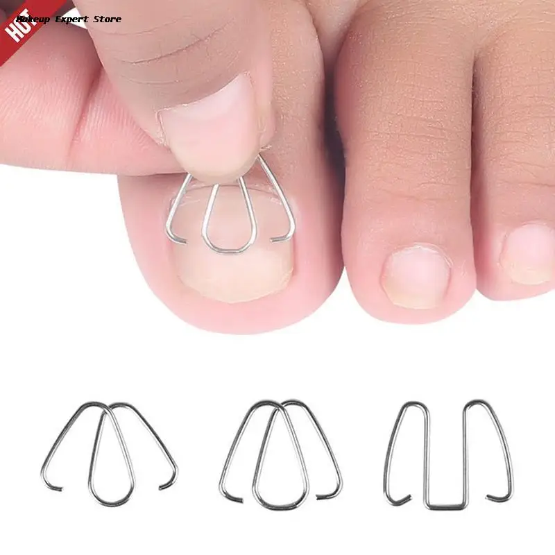 Ingrown Toenail Pedicure Tool Straightening Correction Clip Curved