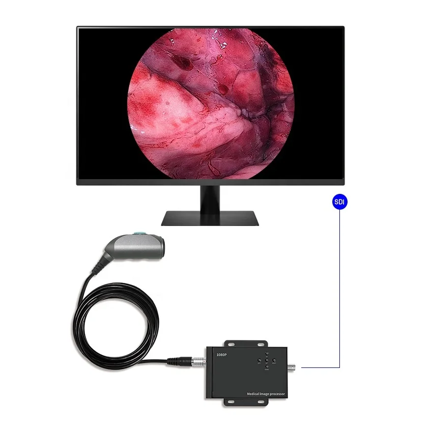 

Cheap Portable Medical Veterinary Endoscope Price with 1080P Fhd Ent Endoscopy Camera