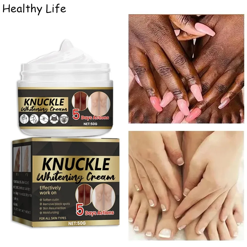 

Nicotinamide Whitening Cream For Butt Armpit Knuckles Cream Whiten Elbow Knee Private Parts Body Lotion Black Skin Brighten Care