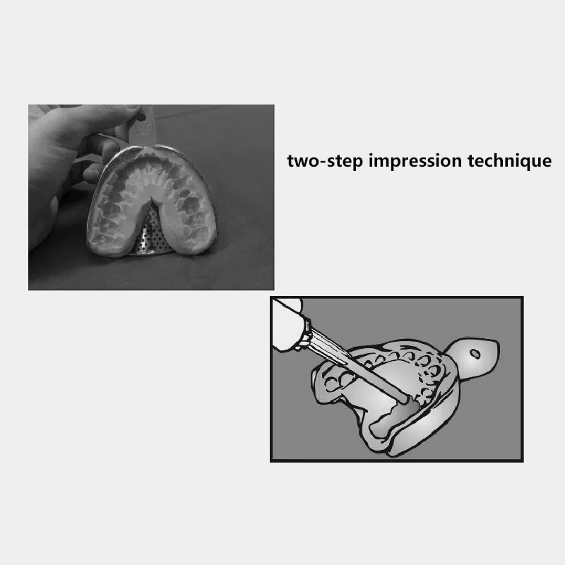 Easy Impression Technique - A SIlicone