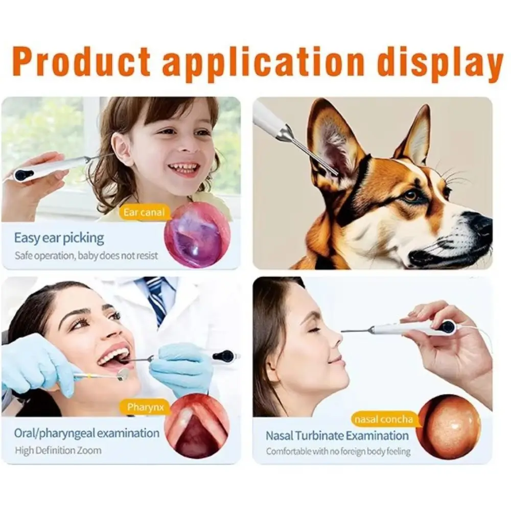 3.2mm 10.1 Inch HD Screen Digital ENT Endoscope Otoscope Ear Scope  Ear Cleaner for clinic, With 3500mAh Rechargeable Battery 2