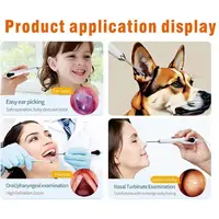 3.2mm 10.1 Inch HD Screen Digital ENT Endoscope Otoscope Ear Scope  Ear Cleaner for clinic, With 3500mAh Rechargeable Battery 2