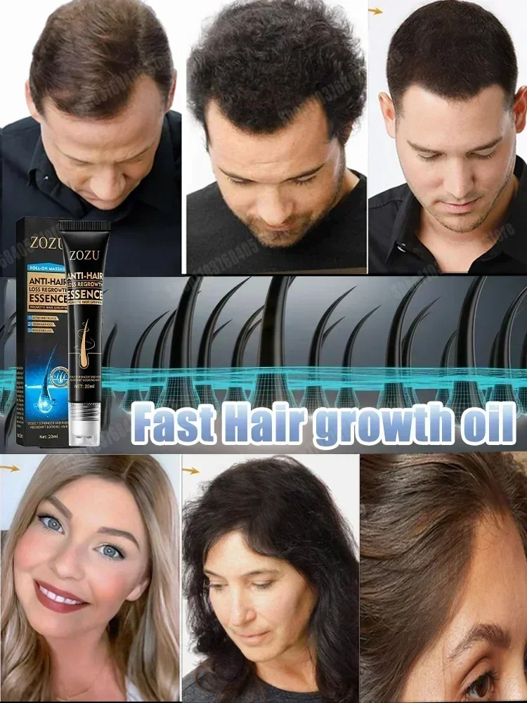 Fast Hair Growth Essence Effective Anti Hair Loss Serum Baldness Repair Hereditary Postpartum Seborrheic Loss oil Care