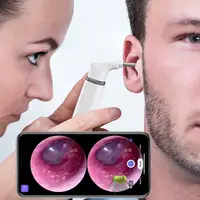 Wifi Ear Otoscope 3.9mm Smart Wireless Portable Visual Earwax Cleaning Endoscope Camera for iPhone Android Phone iPad 1