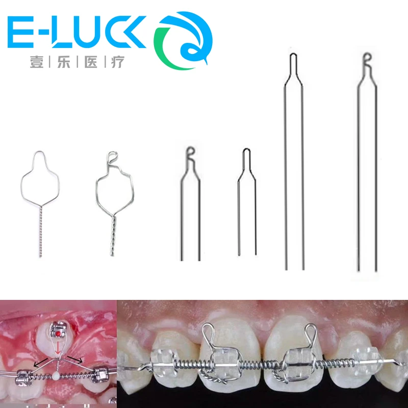 100pcs/pack Orthodontic Wire Dental Ligature Wires Kobayashi Metal