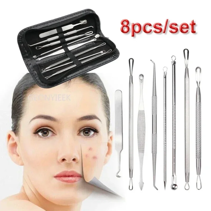 Blackhead Instrument Blackhead Remover Facial Beauty Instrument 8pcs/set Blackhead Comedone Acne Pimple Blackhead Remover Tool Spoon for Face Skin Care Tool Needles Facial Pore Cleaner