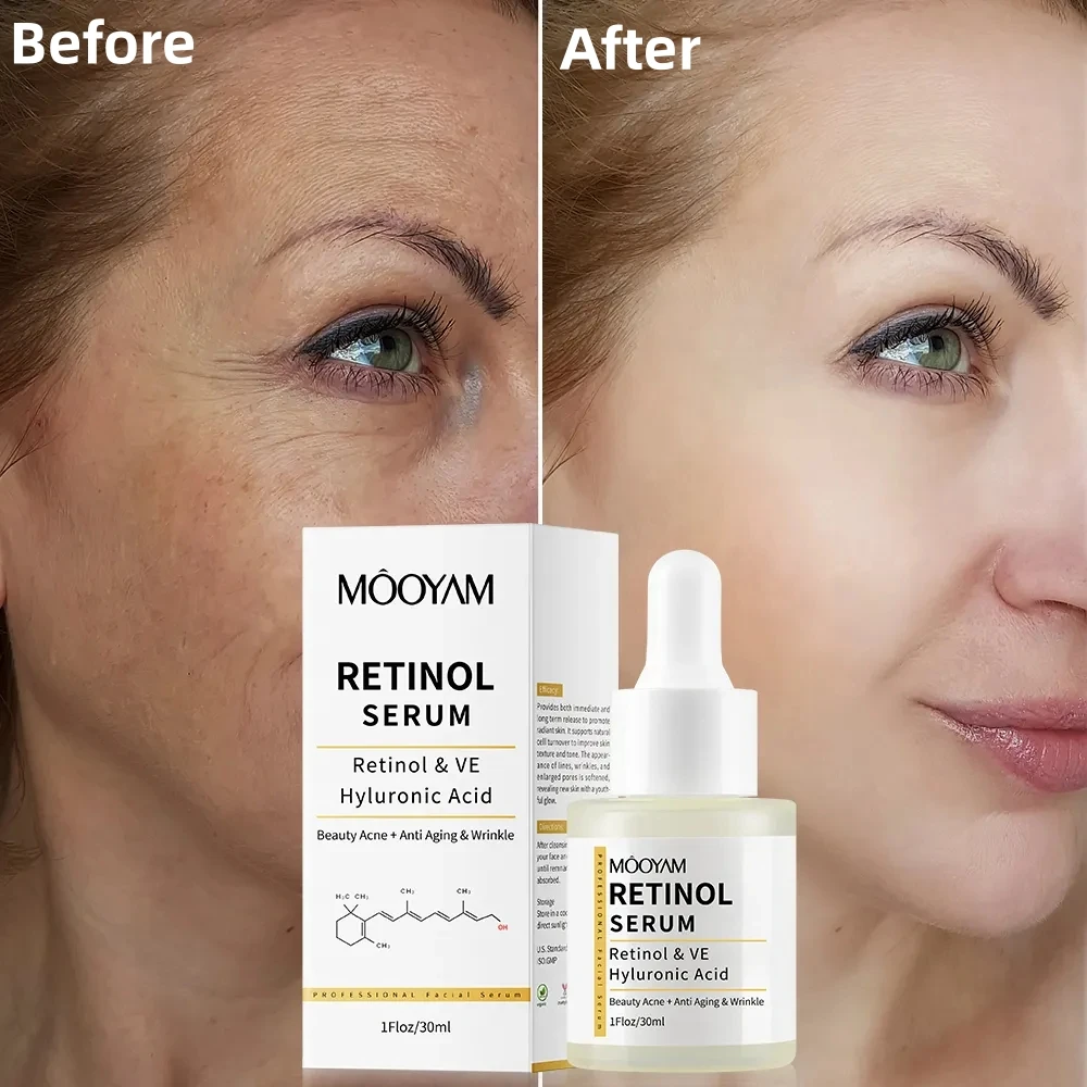 2.5% Retinol With Hyaluronic Acid VE Face Serum Effectively Anti-Aging Wrinkles Smooth Skin Acne Retinol Facial Essence ollin care restore serum with flax seeds сыворотка восстанавливающая с экстрактом семян льна 150 мл