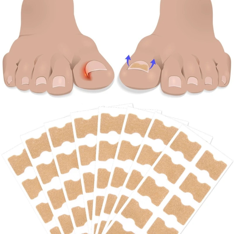 Toenail corrector patch 100pcs paronychia correction ingrown tools pedicure removal stickers