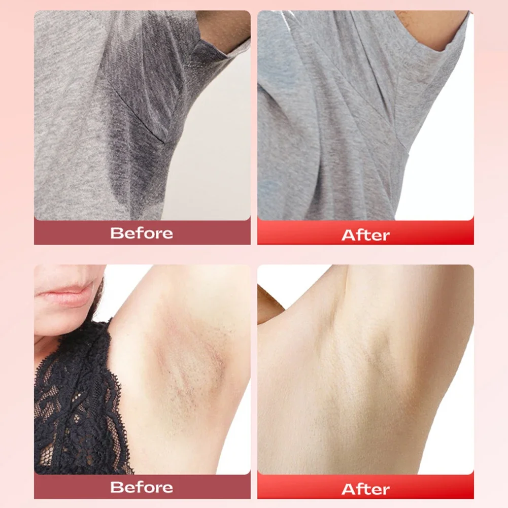 Body Odor Remove Gel Scent Deodorant Stick for Underarm Bad Smell Sweating Removing 80g