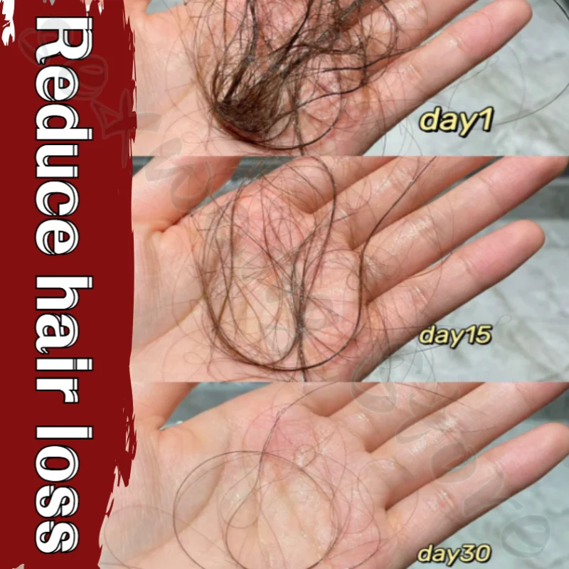 10 Kinds of Chinese Herbal Extracts: Platycladus Orientalis Leaf Saponin Hair Powder To Prevent Hair Loss and Strengthen Hair 4