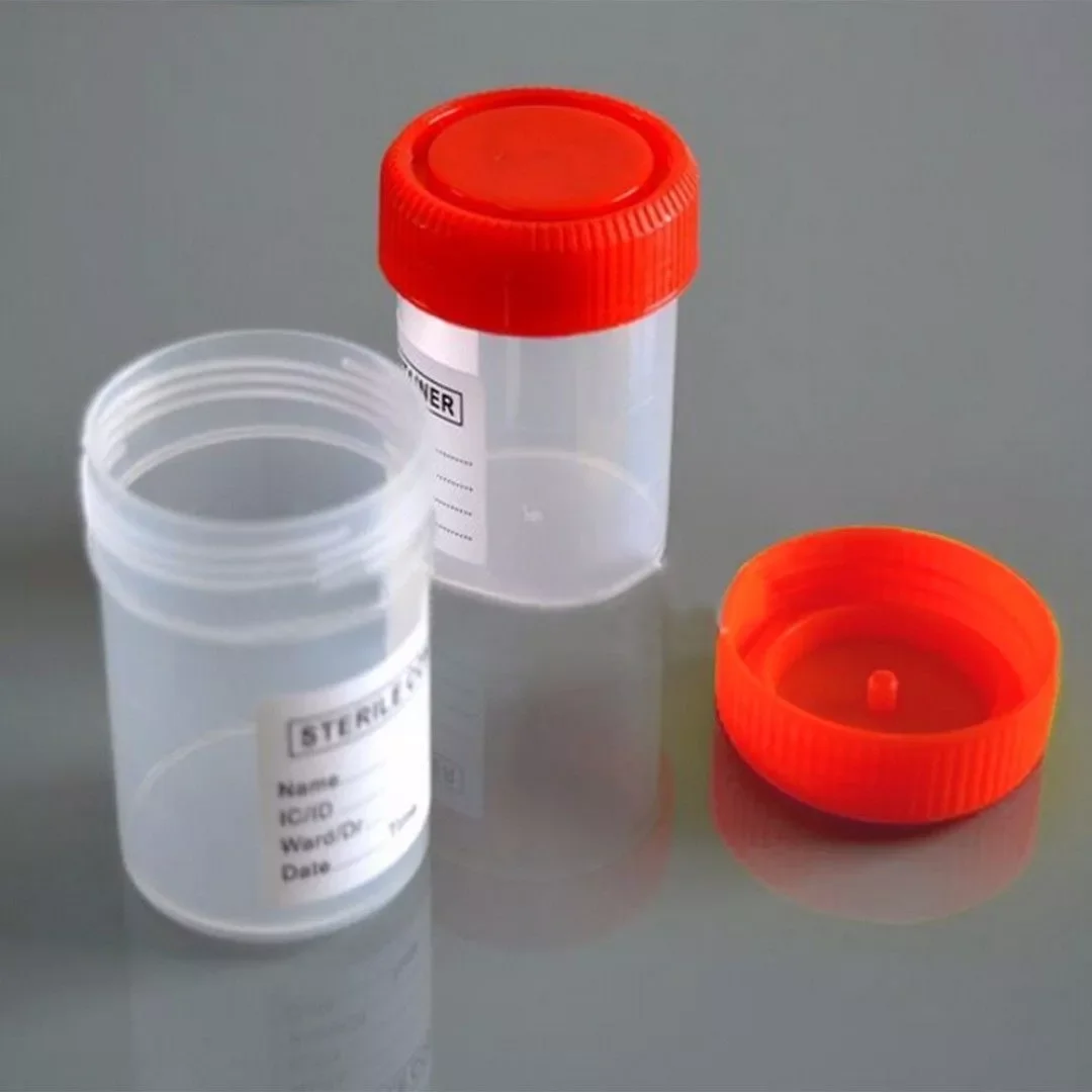 5pcs 60ML Urine Collection Specimen Bottle Sample Top Cup Pot Container Disposable Sampling Sputum Cup with Lid ,scale, Label