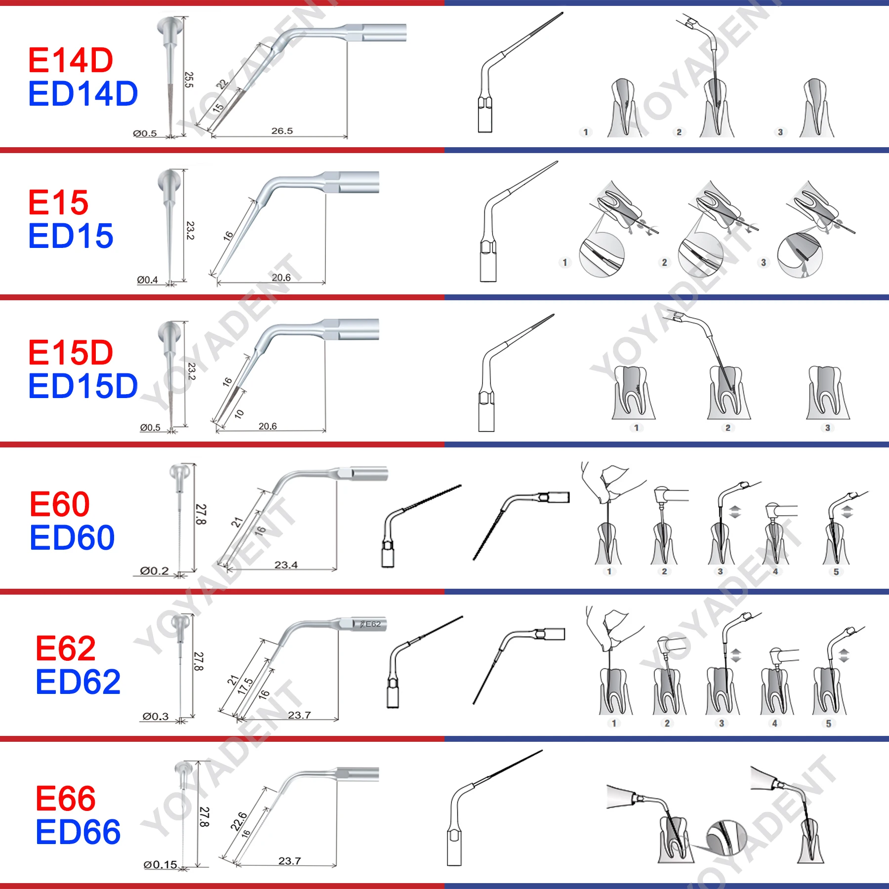 Woodpecker DTE Dental Endo Tips Ultrasonic Scaler Tips Scaling Tips ED-Series Fit NSK SATELEC Scaler Handpiece Dentistry Product 5