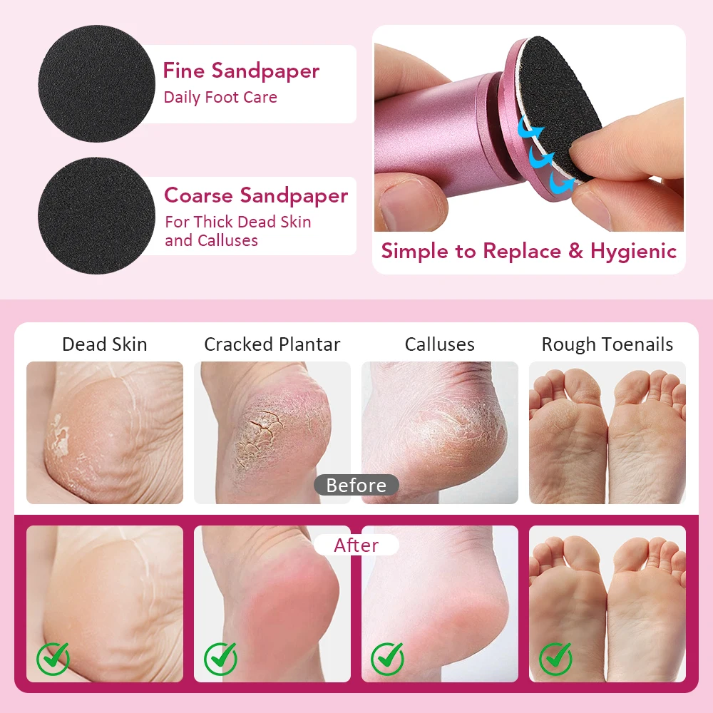 Râpe électrique pour pieds anti-callosités et peaux mortes_voghion.com