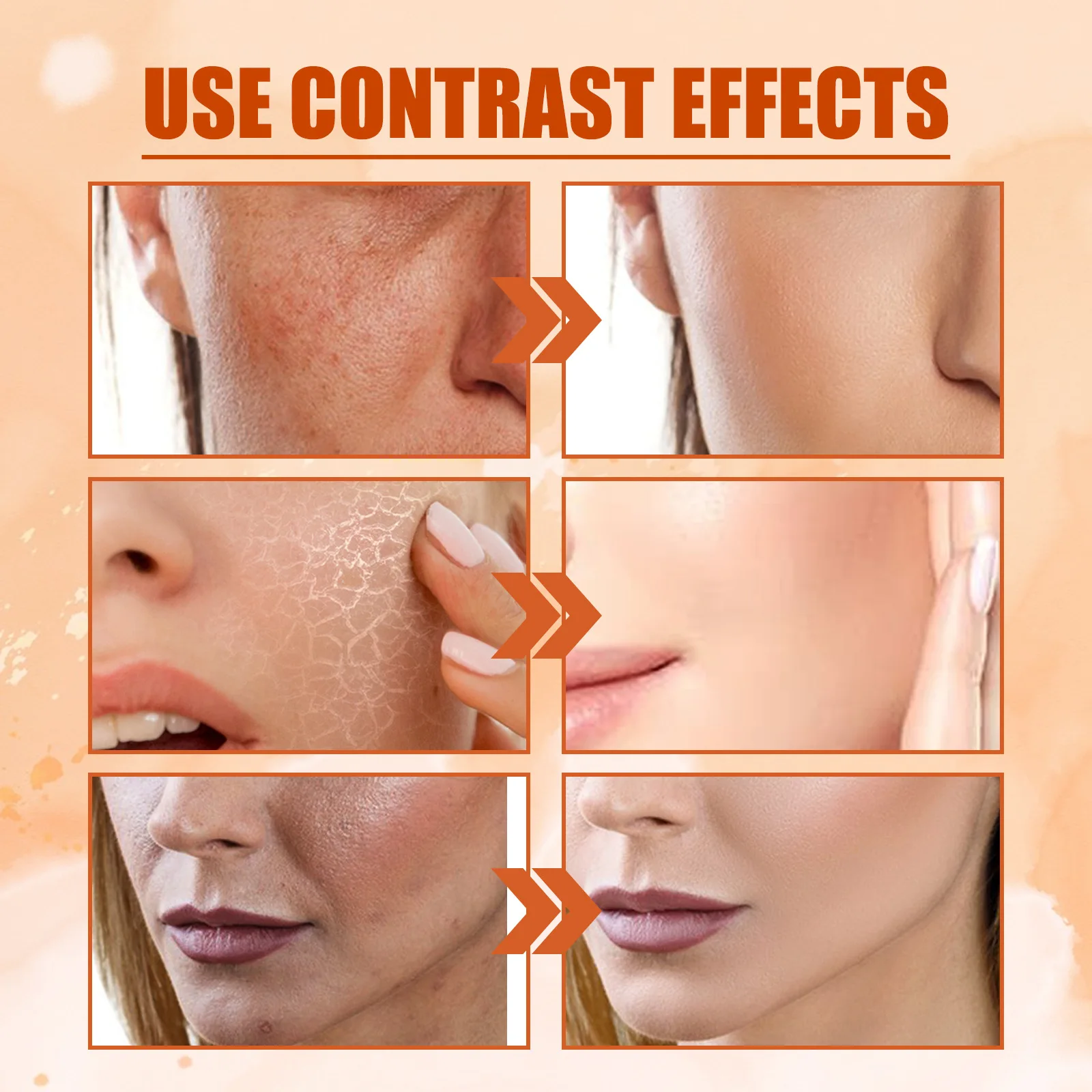 Siero viso sbiancante per lentiggini alla vitamina C Rimuovi le macchie scure Dissolvenza Melasma Anti-età Illumina Tonico idratante all'essenza_voghion.com
