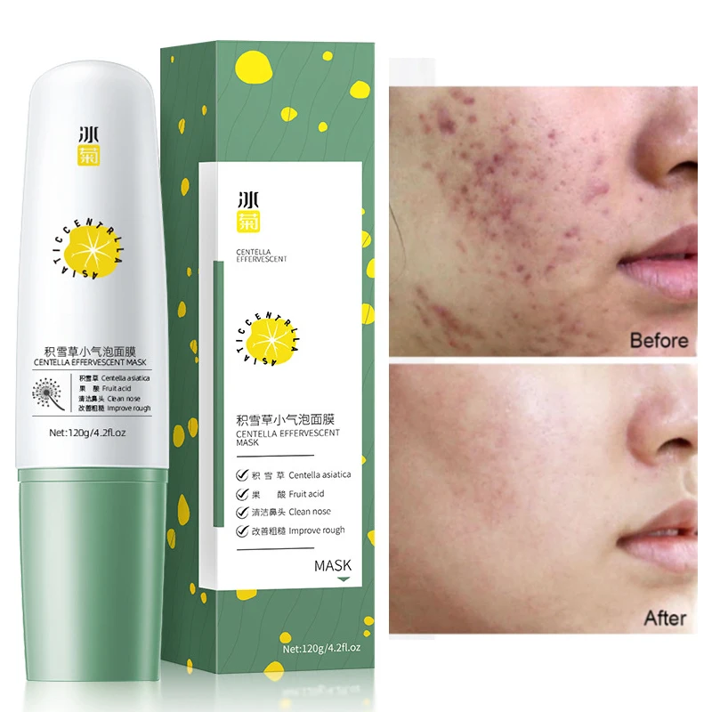 Facial Mask Moisturizing Brighten Skin Tone Shrink Pores Oil Control Anti-Acne Remove Blackheads Deep Cleaning Face Care 120g