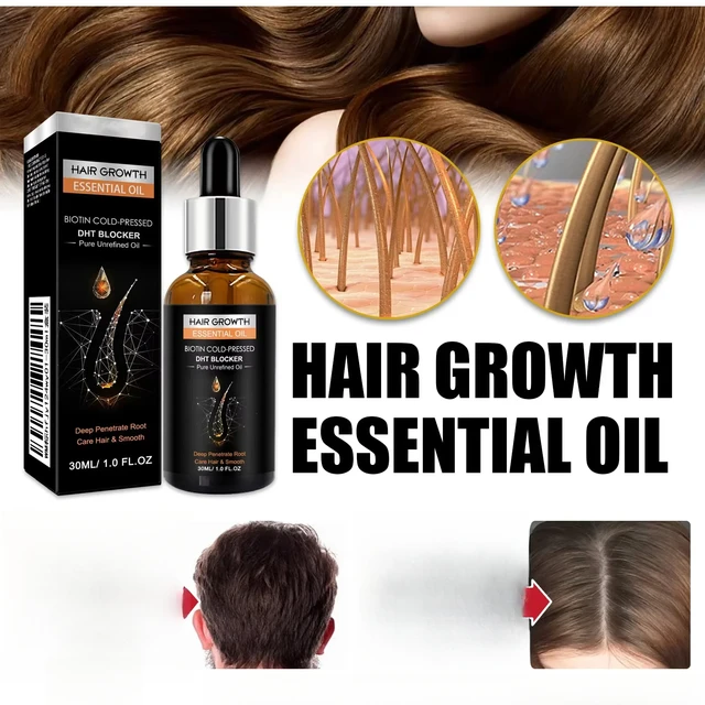 Réachat élevé, huile de croissance des cheveux, bloqueur de biotine DHT, shampoing Anti-perte, repousse, augmente la Production de shampoing, croissance des cheveux 1