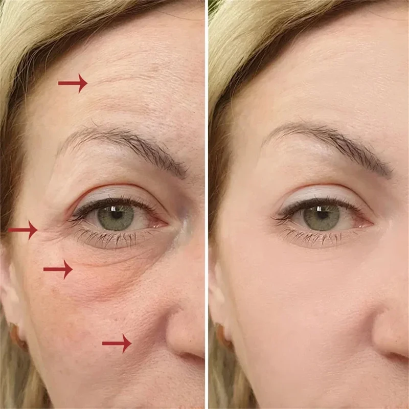 Pure Hyaluronic Acid Remove Wrinkle Face Serum Firming Lift Anti-Aging Serum Fade Fine Lines Improve Puffiness Korean Skin Care 2