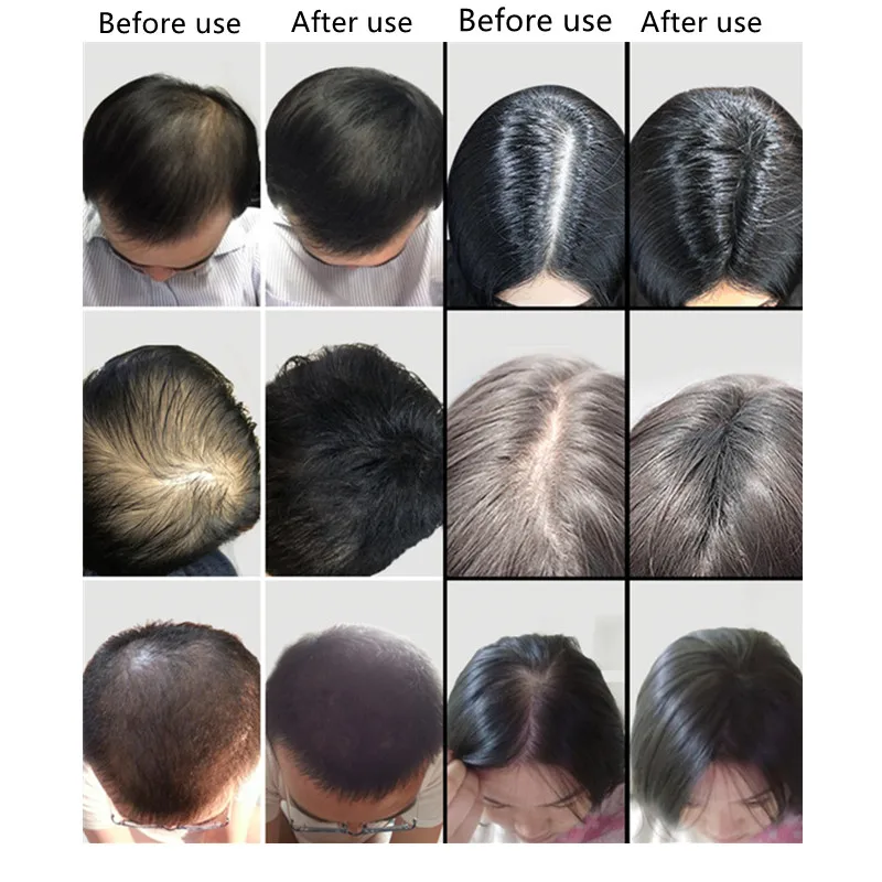 9 Color Hair Fibers Regrowth Powders Keratin Applicator Hair Building Fibers Spray Pump Hair Growth Products Beauty Health 27.5g
