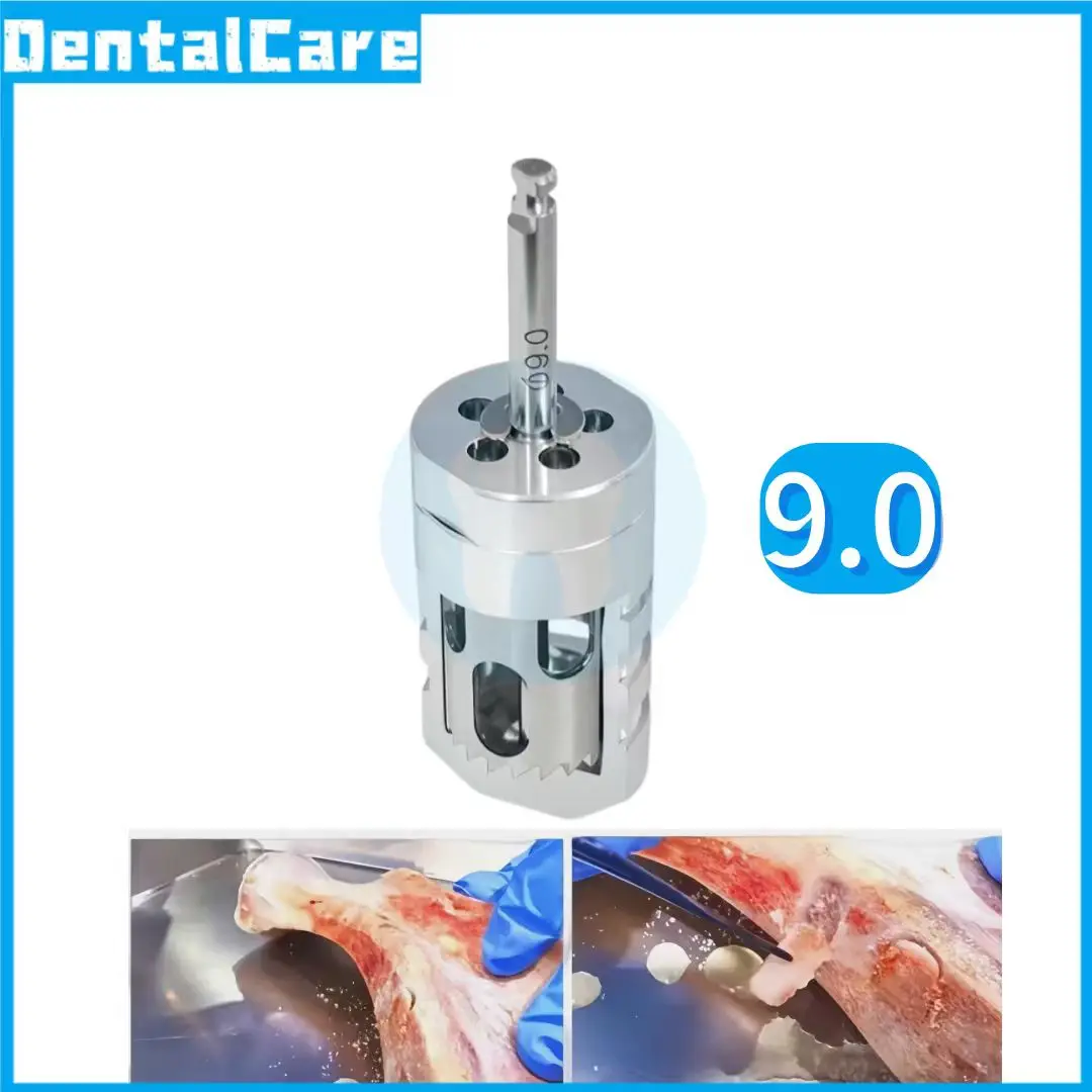 1 Stk. Dentaler Semilunar-Knochenkollektor-Bohrer GBR SLT Semilunar-Technik Semilunar-Knochenkollektor für einfache Knochenentnahme