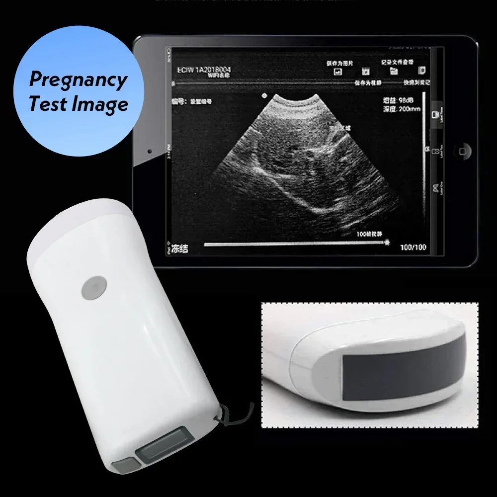 Wireless Veterinary Ultrasound Scanner Handheld Ultrasound Machine Wireless Colo