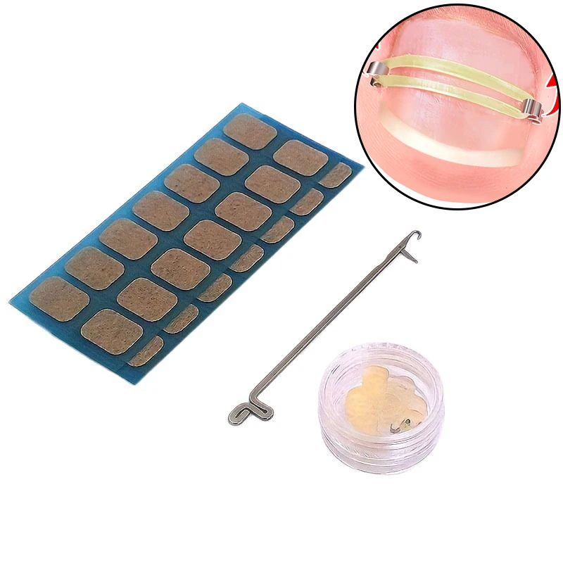alt="A Professional Kit of Ingrown Toenail Corrector Tools for Embed Toe Nail Treatment.