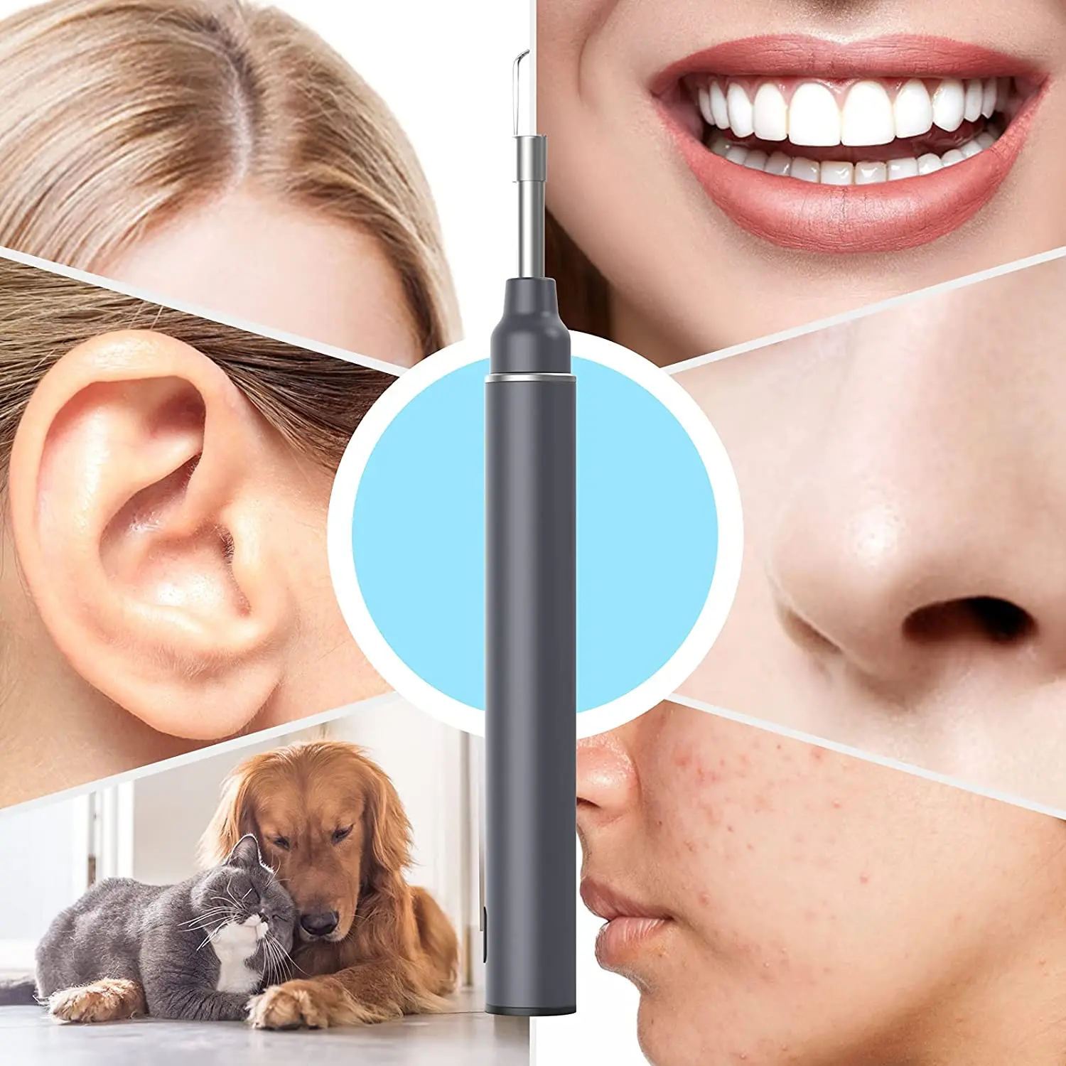 Vitcoco Otoscope Ear Wax Removal 3.0mm Ultra-thin Otoscope With