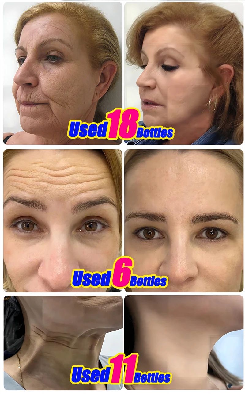 90 Caps Hydrolyzed Collagen Capsules,Remove Spots Wrinkle Eye Bags, Anti-Aging,NAD+ Supplement,Skin Care Repair for Women