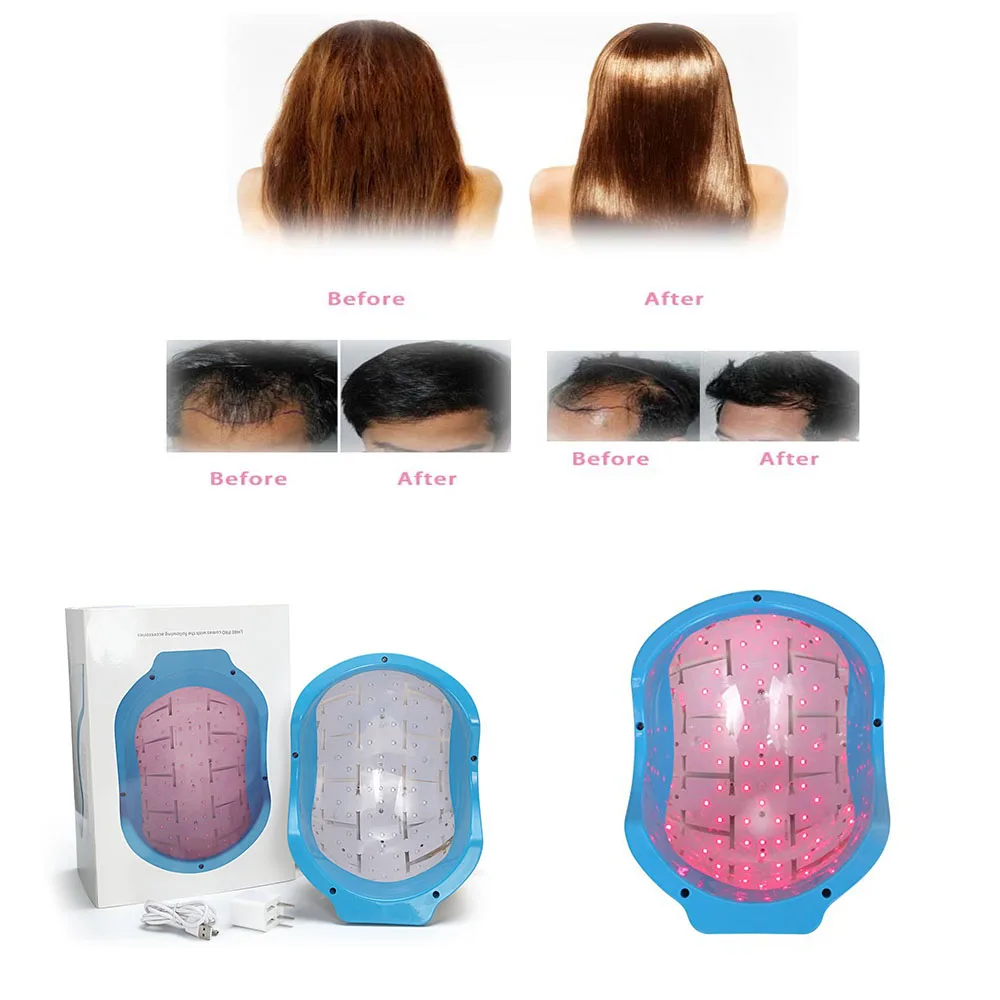

Hair Growth Helmet LLLT Red Light Hair Regrowth Treatment For Men and Women Anti Hair Loss Hair Restore Products