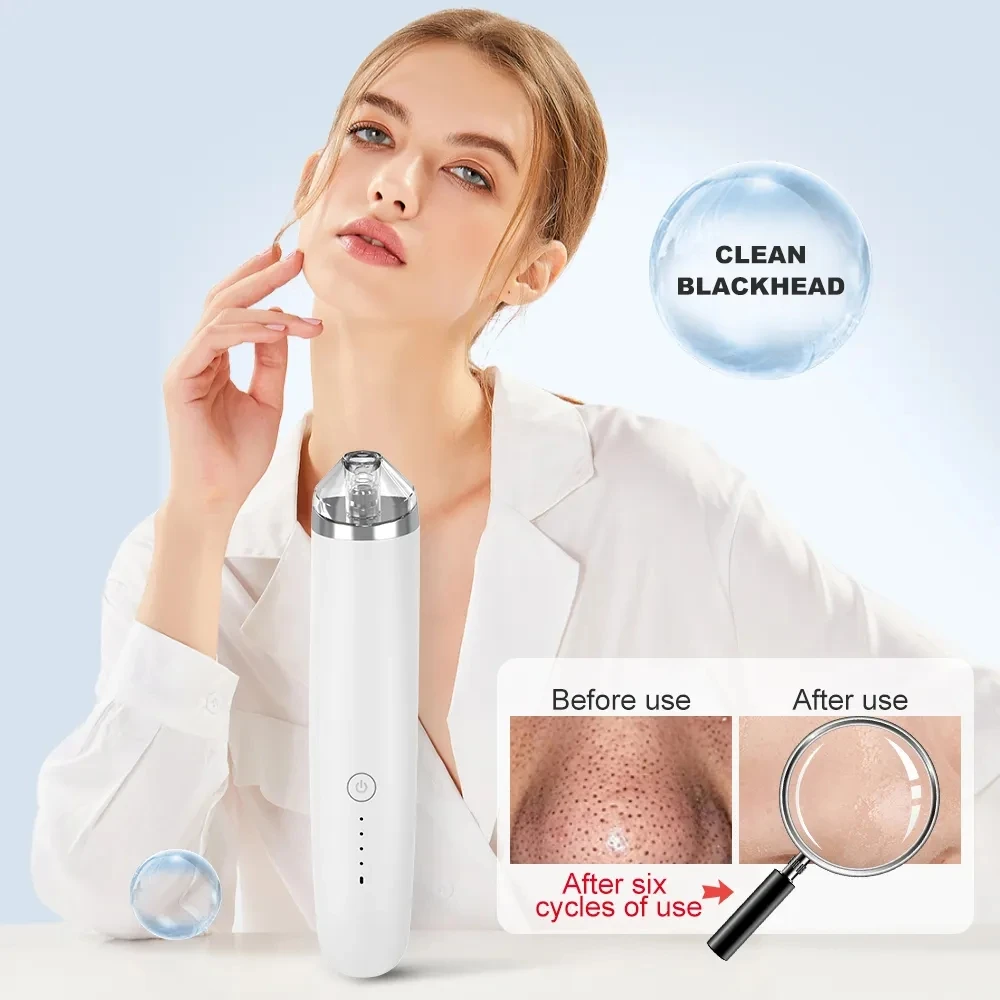 Blackhead Remover USB Rechargeable Facial Pore Cleaner Vacuum Suction Comedone Acne Pimple Black Head Extractor Care Tools