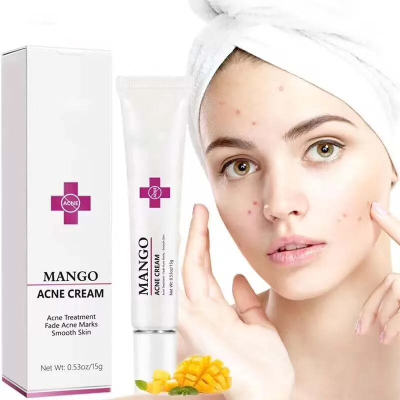 

15g Mango Facial Acne Cream for Face Balance oil Improve Acne Marks Smooth and Rejuvenate Skin Skincare Face Cream Dark Remover
