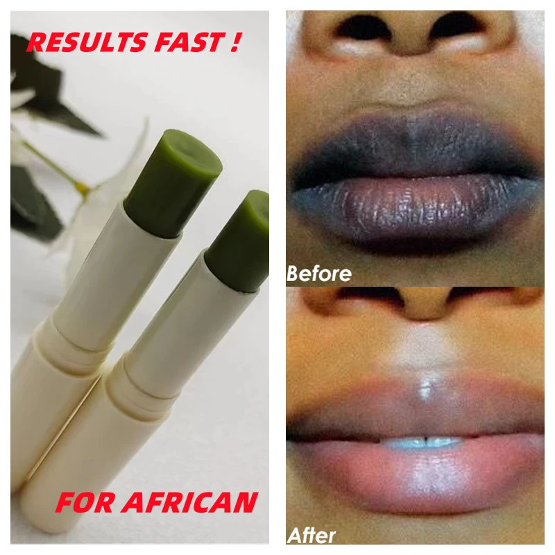 2 Pcs Lips African Darkness Removal Lip Balm Whitening Moisturizer
