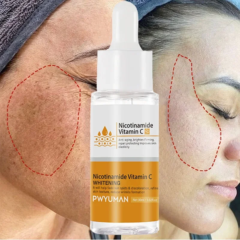 

Vitamin C Whitening Freckles Face Serum Remove Dark Spots Melasma Niacinamide Lighten Melanin Fade Acne Scars Brighten Skin Care