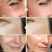 Retinol Wrinkle Remover Face Set Instant Firming Lifting Anti-Aging Serum Fade Fine Lines Whitening Korean Skin Care Products 2