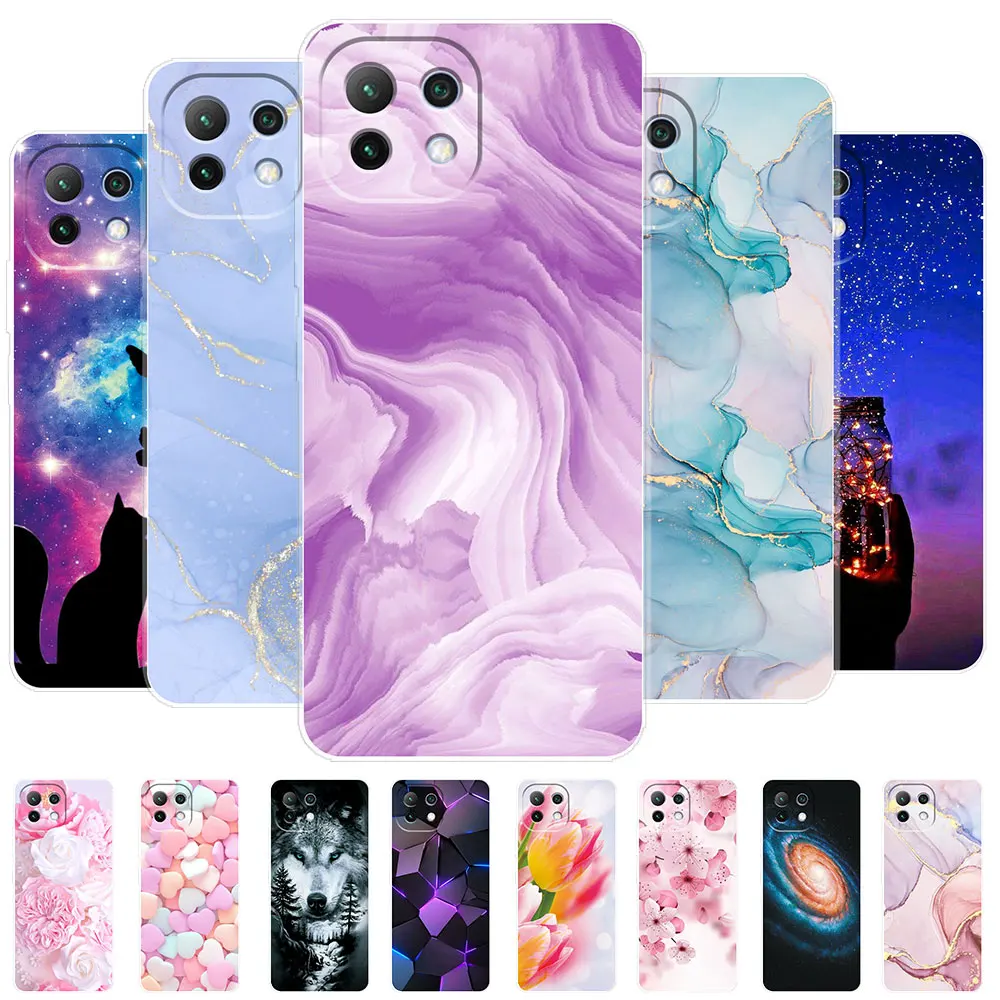 Per Xiaomi Mi 11 Lite 5G Ne Case Mi 11 Lite 4G 5G Fundas Custodia Morbida In Silicone Per Xiaomi Mi 11 Mi 11 Pro Cover Mi 11 Ultra