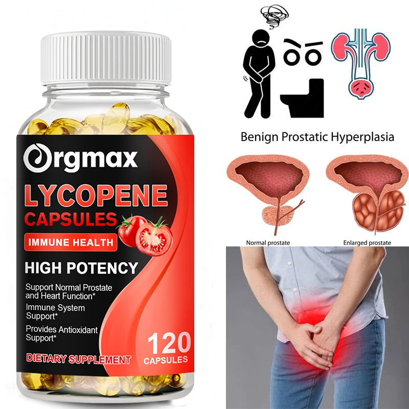 

Lycopene Capsules Tomato Extract Immunity Sperm Cure Prostate Health Heart & Cardiovascular System Health Antioxidant