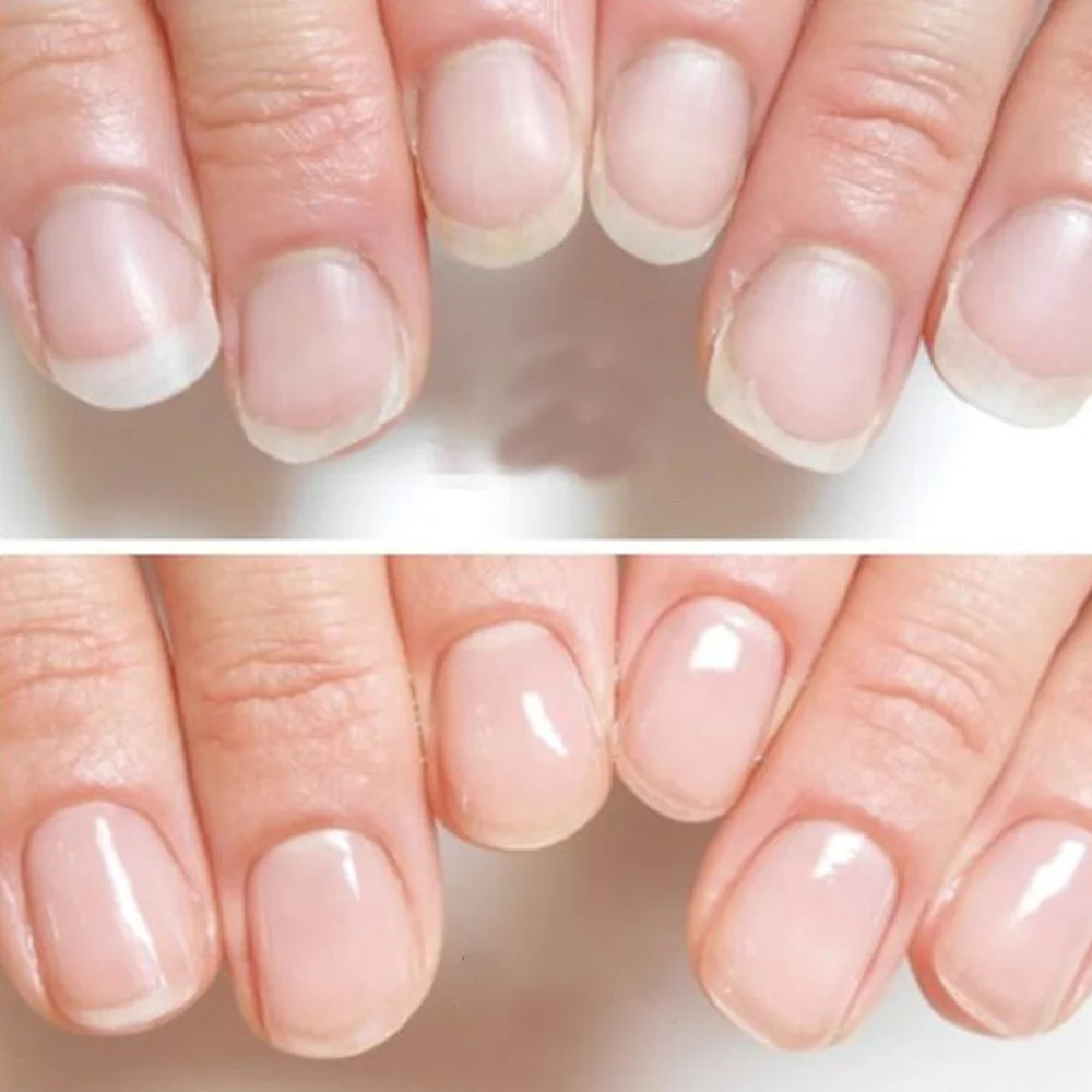 Tinovo Uno Natural Nail Growth Complex 9 IN 1 Nail Art Treatment Therapy for Repair Care Thin Brittle Nails Top Coat Hardener 6