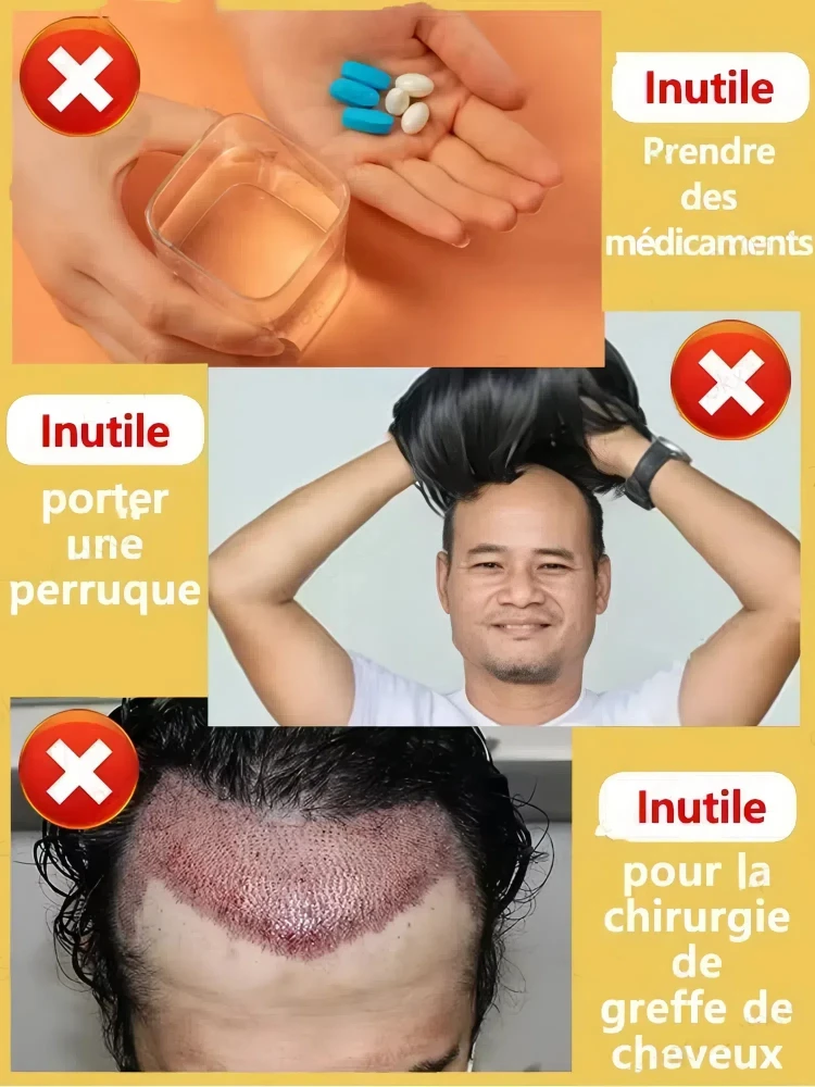 Revive Hair Strong Penetration Activate Hair Roots More Hair Say Goodbye to Baldness Thick Hair hair growth serum hair building powder hair building fibers hair growth spray hair growth cream hair growth shampoo set
